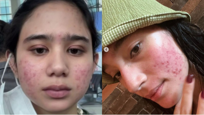 Tissa Biani dan Tatjana Saphira
