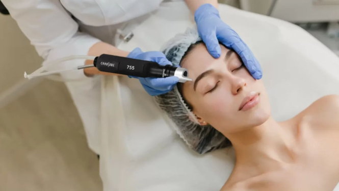 Ilustrasi treatment wajah pico laser