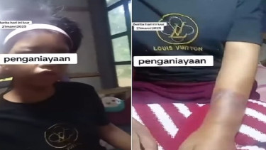 Seorang ART asal Banyumas dianiaya majikannya di Pulogadung