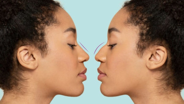 Ilustrasi Contour Hidung