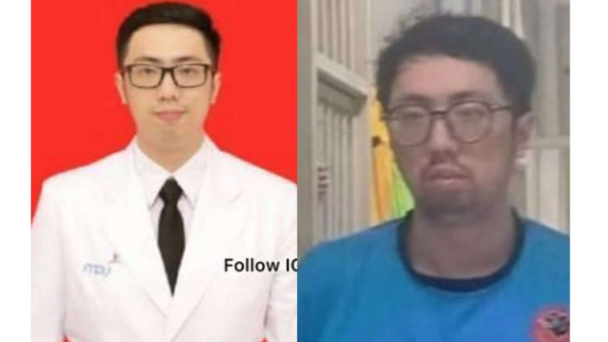 Tampang Dokter PPDS Unpad yang Perkosa Keluarga Pasien di Gedung RSHS Bandung