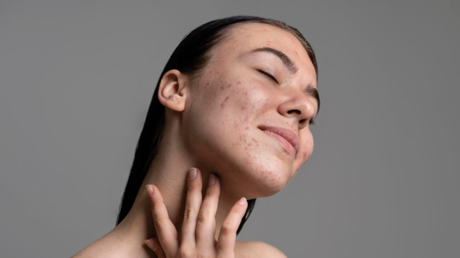 skinimalisme
