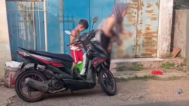 Ibu dan Anak 10 Tahun di Sukabumi Disiram Air Keras