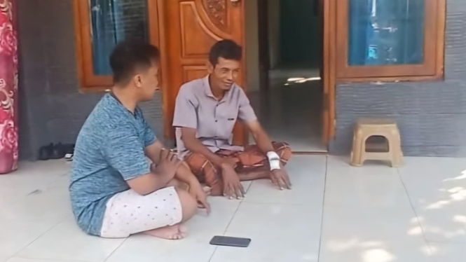 Salah satu warga yang terkena sepihan akibat truk TNI terbakar
