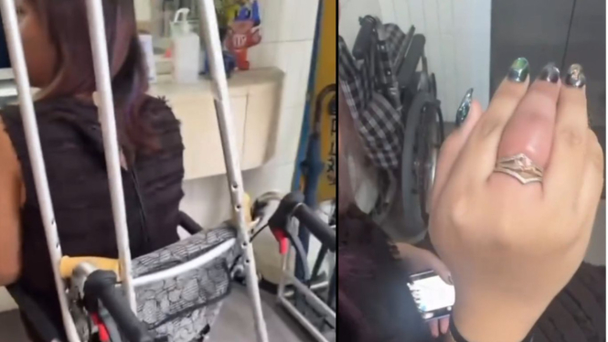 Kondisi Putri Eko Patrio di Jepang