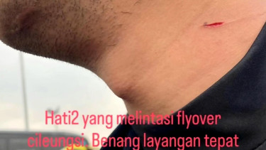 Cerita leher pengendara motor tersayat benang layangan