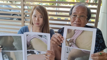 Ibu muda alami KDRT laporkan suaminya ke Polrestabes Surabaya