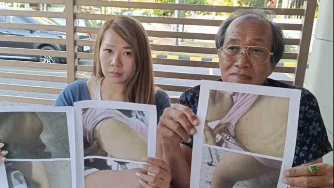 Ibu muda alami KDRT laporkan suaminya ke Polrestabes Surabaya